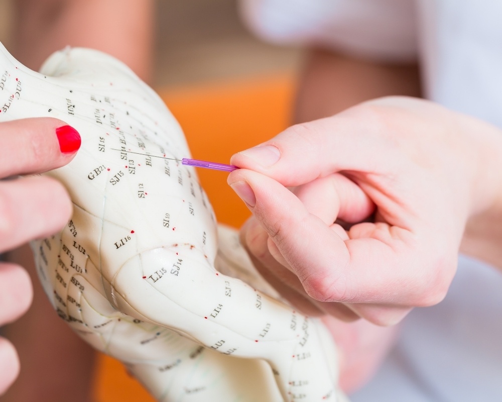 Acupuntura: Prevenção ou Tratamento?
