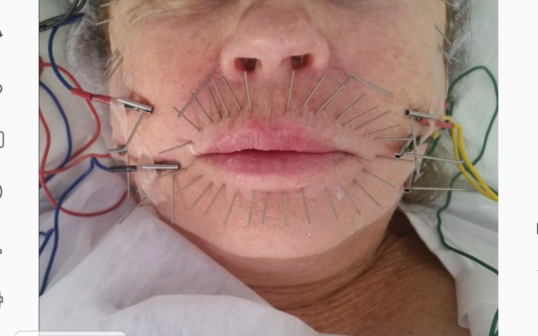 “REVELANDO A ACUPUNTURA ESTÉTICA”