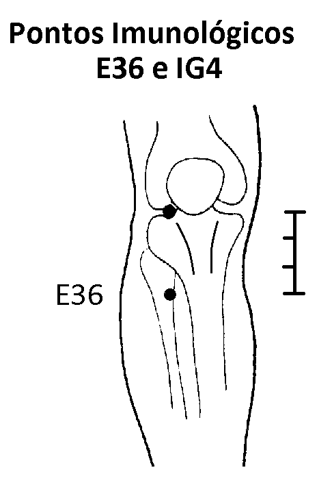 Localização do Ponto Estômago 36, 3 polegadas abaixo do joelho, e 1 polegada lateral à crista da tíbia
