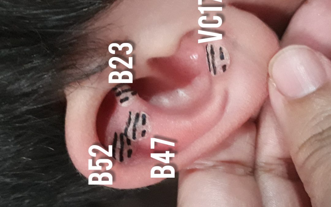 AURICULOTERAPIA DOS MICROMERIDIANOS NO TRATAMENTO DAS  EMOÇÕES, COM TRIGRAMAS