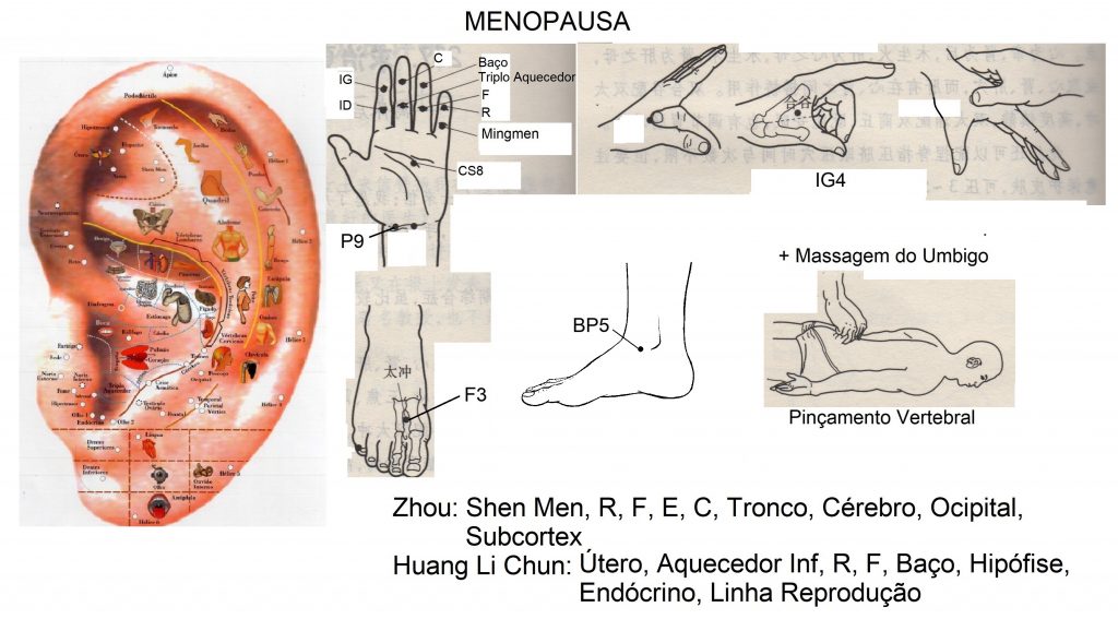 Pontos IG4, F3, P9 e BP5. Esquemas de Auriculoterapia Chinesa de Zhou e Huang. E mapa de Wu