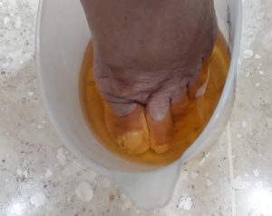 Dedo do pé mergulhado na urina